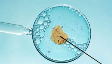 Thụ tinh nhân tạo IUI là gì? Quy trình và tỷ lệ thành công